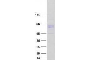 Validation with Western Blot