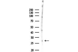 Western blot analysis of lysates from 3-L1 P6(LPS, 4h treatment), using HOX Antibody at 1/1000 dilution.