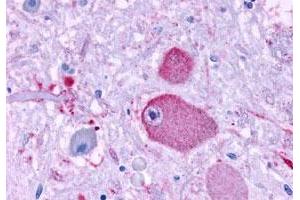 Immunohistochemistry (Formalin/PFA-fixed paraffin-embedded sections) of human brain, neurons and glia with GPR37 polyclonal antibody . (GPR37 anticorps  (Extracellular Domain))