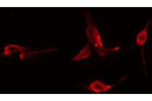 ABIN6276024 staining  Hela cells by IF/ICC. (GPRC5B anticorps  (Internal Region))