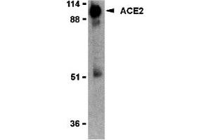 Western Blotting (WB) image for anti-Angiotensin I Converting Enzyme 2 (ACE2) (Middle Region 2) antibody (ABIN1031195) (ACE2 anticorps  (Middle Region 2))