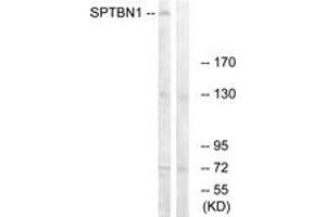 Western blot analysis of extracts from COLO cells, using SPTBN1 Antibody. (SPTBN1 anticorps  (AA 651-700))