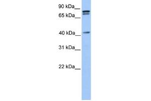 WB Suggested Anti-SUZ12 Antibody Titration:  0. (SUZ12 anticorps  (C-Term))