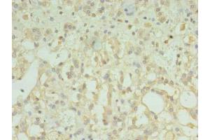 Immunohistochemistry of paraffin-embedded human adrenal gland tissue using ABIN7173203 at dilution of 1:100 (TMEM33 anticorps  (AA 177-247))
