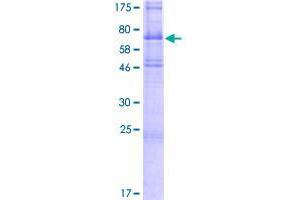 Image no. 1 for Transmembrane Protein with EGF-Like and Two Follistatin-Like Domains 2 (TMEFF2) (AA 1-374) protein (GST tag) (ABIN1322945)