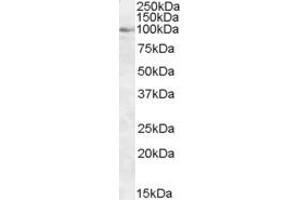 Western Blotting (WB) image for anti-Oxysterol Binding Protein (OSBP) (AA 794-807) antibody (ABIN292164) (OSBP anticorps  (AA 794-807))