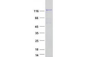 Validation with Western Blot