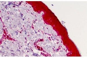 Human Skin: Formalin-Fixed, Paraffin-Embedded (FFPE) (Caspase 4 anticorps)