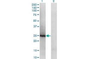 Western Blot analysis of TSN expression in transfected 293T cell line by TSN polyclonal antibody (A01). (Translin anticorps  (AA 115-197))