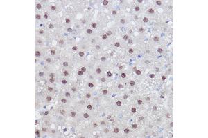 Immunohistochemistry of paraffin-embedded rat liver using PPARD Rabbit pAb (ABIN6132423, ABIN6146002, ABIN6146003 and ABIN6221300) at dilution of 1:100 (40x lens).