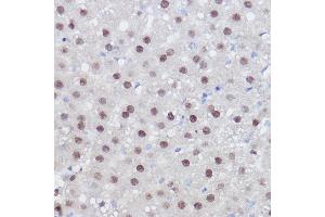 Immunohistochemistry of paraffin-embedded rat liver using PPARD Rabbit pAb (ABIN6132423, ABIN6146002, ABIN6146003 and ABIN6221300) at dilution of 1:100 (40x lens). (PPARD anticorps  (AA 102-361))