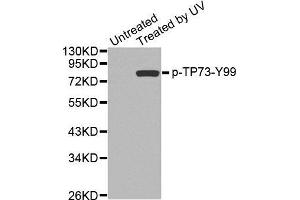 Western blot analysis of extracts from 293 cells, using Phospho-TP73-Y99 antibody. (Tumor Protein p73 anticorps  (pTyr99))