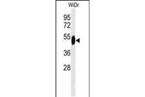 Western blot analysis of SETD6 Antibody in WiDr cell line lysates (35ug/lane) (SETD6 anticorps  (C-Term))