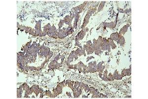 IHC analysis of PPT1 using anti PPT1 antibody (ABIN6719501).