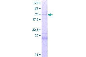 Image no. 1 for Golgin, RAB6-Interacting (GORAB) (AA 1-246) protein (GST tag) (ABIN1319323)