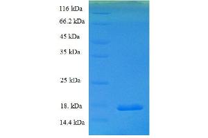 Potassium Voltage-Gated Channel, Isk-Related Family, Member 2 (KCNE2) (AA 70-123) protein (His tag) expressed in E.