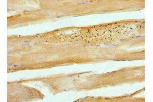Immunohistochemistry of paraffin-embedded human skeletal muscle tissue using ABIN7146447 at dilution of 1:100 (CAMK2B anticorps  (AA 1-300))