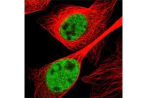 Immunofluorescent staining of human cell line U-2 OS shows positivity in nucleus but not nucleoli. (SMEK2 anticorps)