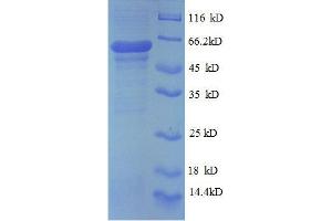 Prolyl 4-Hydroxylase, beta Polypeptide (P4HB) (AA 29-313), (partial) protein (GST tag)