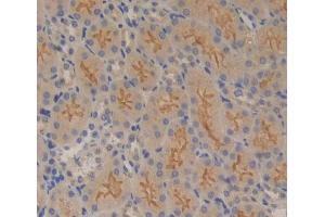 IHC-P analysis of Kidney tissue, with DAB staining. (PTPRB anticorps  (AA 1214-1463))