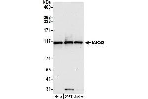 anti-Isoleucyl-tRNA Synthetase 2, Mitochondrial (IARS2) (AA 962-1012) antibody