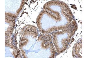 IHC-P Image DDB1 antibody detects DDB1 protein at nucleus and cytosol on mouse prostate by immunohistochemical analysis. (DDB1 anticorps  (C-Term))