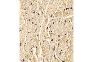 (ABIN656585 and ABIN2845847) staining PLOD1 in Human heart tissue sections by Immunohistochemistry (IHC-P - paraformaldehyde-fixed, paraffin-embedded sections). (PLOD1 anticorps  (N-Term))