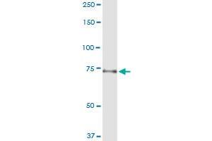 anti-Tubulin, gamma Complex Associated Protein 4 (TUBGCP4) (AA 1-666) antibody