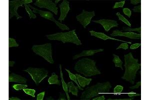 anti-UBX Domain Protein 11 (UBXN11) (AA 311-409) antibody