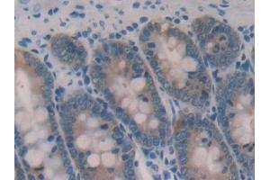 Detection of GAL2 in Rat Small intestine Tissue using Polyclonal Antibody to Galectin 2 (GAL2) (Gallinacin-2 (GAL2) (AA 1-130) anticorps)