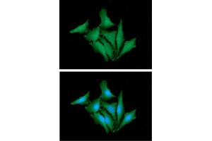 ICC/IF analysis of HPRT in HaLe cells.