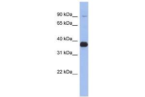 MPP3 antibody used at 1 ug/ml to detect target protein. (MPP3 anticorps)