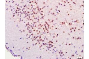 Paraformaldehyde-fixed, paraffin embedded Mouse brain, Antigen retrieval by boiling in sodium citrate buffer (pH6.