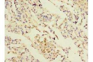 Immunohistochemistry of paraffin-embedded human lung tissue using ABIN7166622 at dilution of 1:100 (Surfactant Protein C anticorps  (AA 24-58))