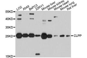 Western blot analysis of extracts of various cells, using CLPP antibody. (CLPP anticorps)
