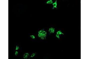 Image no. 3 for anti-Cytidine Monophosphate (UMP-CMP) Kinase 1, Cytosolic (CMPK1) antibody (ABIN1497544) (Cytidine Monophosphate (UMP-CMP) Kinase 1, Cytosolic (CMPK1) anticorps)