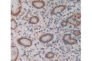 Used in DAB staining on fromalin fixed paraffin- embedded stomach tissue (SIRPB1 anticorps  (AA 127-356))