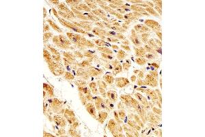 Immunohistochemical analysis of paraffin-embedded H. (NME1 anticorps)