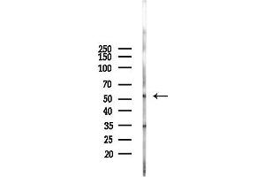 anti-Zinc Finger Protein 277 (ZNF277) antibody