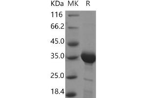 Western Blotting (WB) image for 3-hydroxyanthranilate 3,4-Dioxygenase (HAAO) protein (His tag) (ABIN7321068)