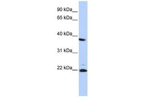 PSMB2 antibody used at 1 ug/ml to detect target protein. (PSMB2 anticorps)