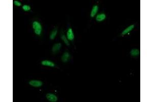 Image no. 4 for anti-Cyclin-Dependent Kinase 2 (CDK2) antibody (ABIN1497394) (CDK2 anticorps)