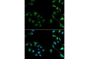 Immunofluorescence analysis of A549 cell using ERK1/2 antibody. (ERK2 anticorps  (AA 200-300))