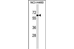 Western blot analysis in NCI-H460 cell line lysates (35ug/lane).