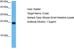 Host: Mouse Target Name: CRYAB Sample Tissue: Mouse Small Intestine Antibody Dilution: 1ug/ml (CRYAB anticorps  (N-Term))