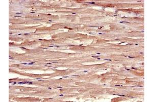 Immunohistochemistry of paraffin-embedded human skeletal muscle tissue using ABIN7171205 at dilution of 1:100 (SYNM anticorps  (AA 1147-1417))