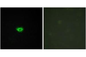 Immunofluorescence analysis of HuvEc cells, using GPR108 Antibody. (GPR108 anticorps  (AA 155-204))