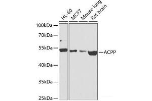 Western blot analysis of extracts of various cell lines using ACPP Polyclonal Antibody at dilution of 1:1000. (ACPP anticorps)