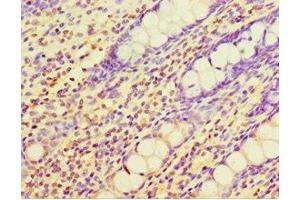 Immunohistochemistry of paraffin-embedded human colon tissue using ABIN7147558 at dilution of 1:100