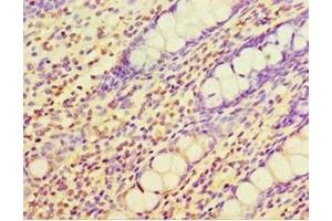 Immunohistochemistry of paraffin-embedded human colon tissue using ABIN7147558 at dilution of 1:100 (CHI3L2 anticorps  (AA 27-390))